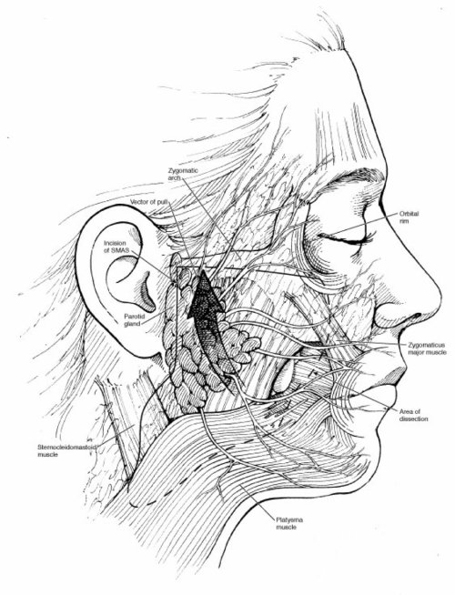 Relevant facial anatomy for Surgeon