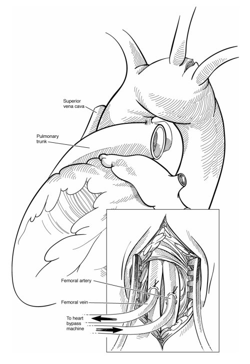 Heart beat medical illustration