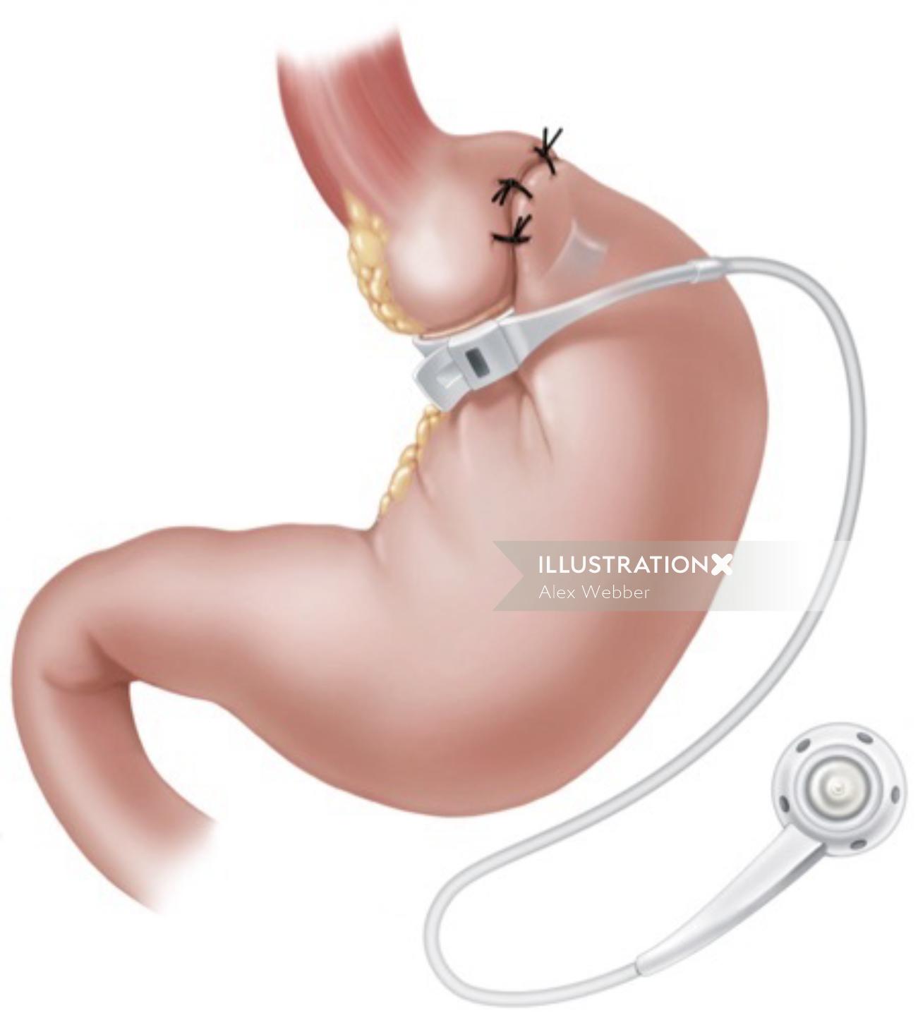Illustration de l&#39;estomac | Collection d&#39;illustration médicale