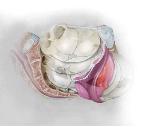Levator Ani Injury medical illustration 