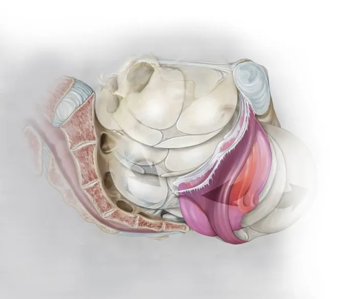 Natural image of Levator ani injury during childbirth