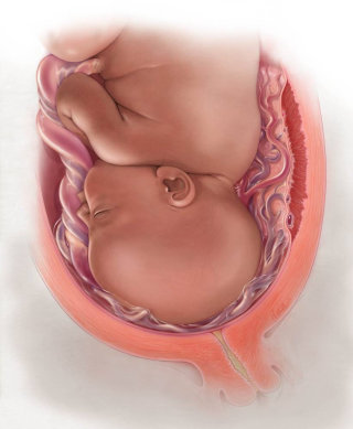 妊娠の自然さは前置胎盤で示される