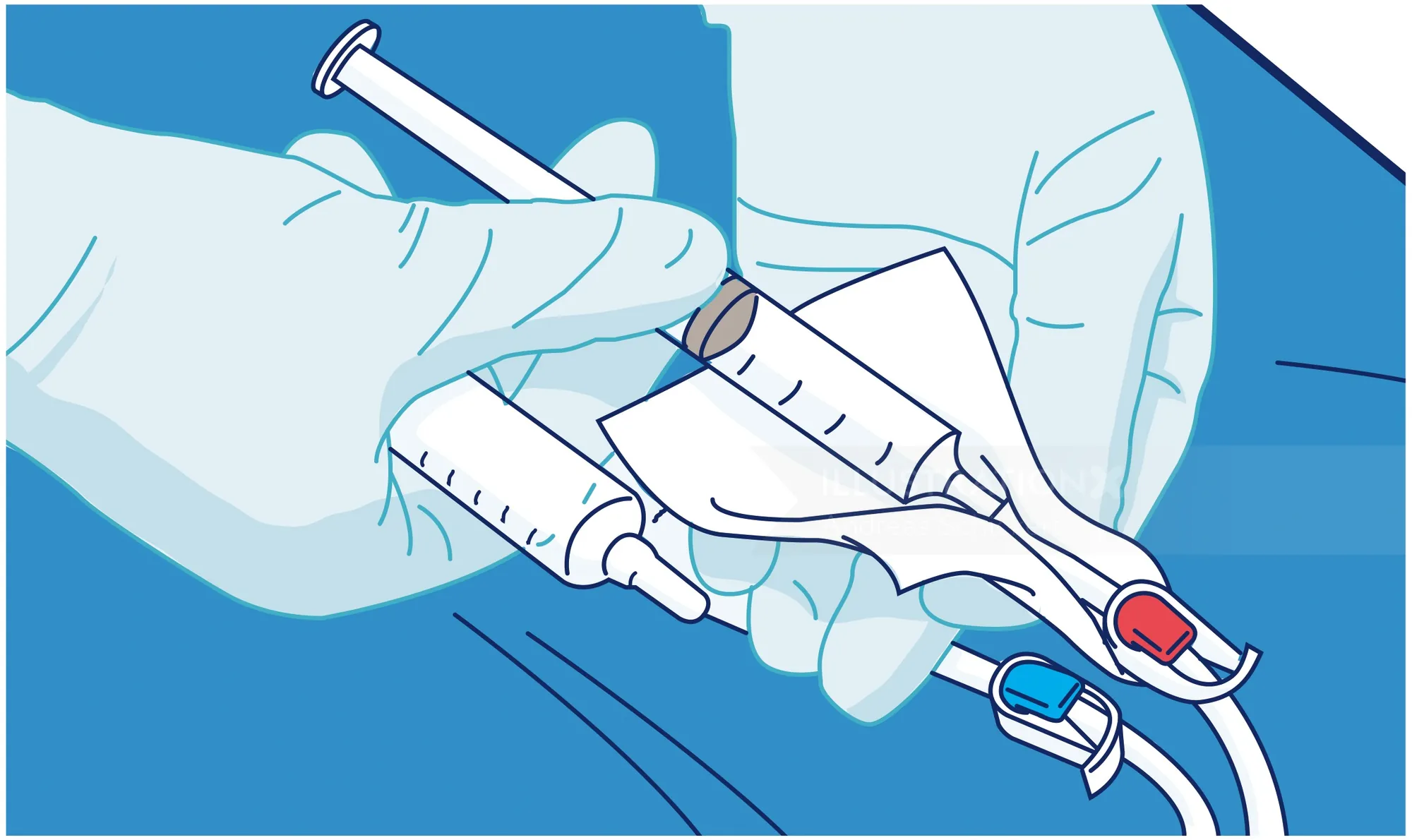 Hands in gloves holding syringe and vial for injection preparation