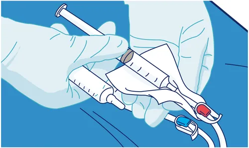 Hands in gloves holding syringe and vial for injection preparation