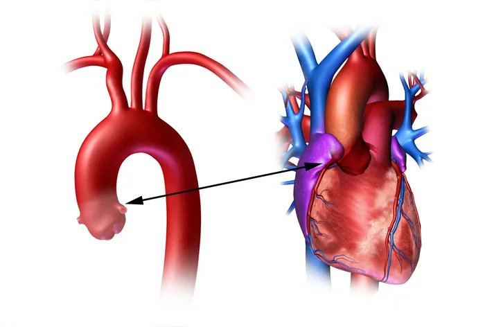 Illustration of human heart showing aortic root and coronary branches by Craig Foster