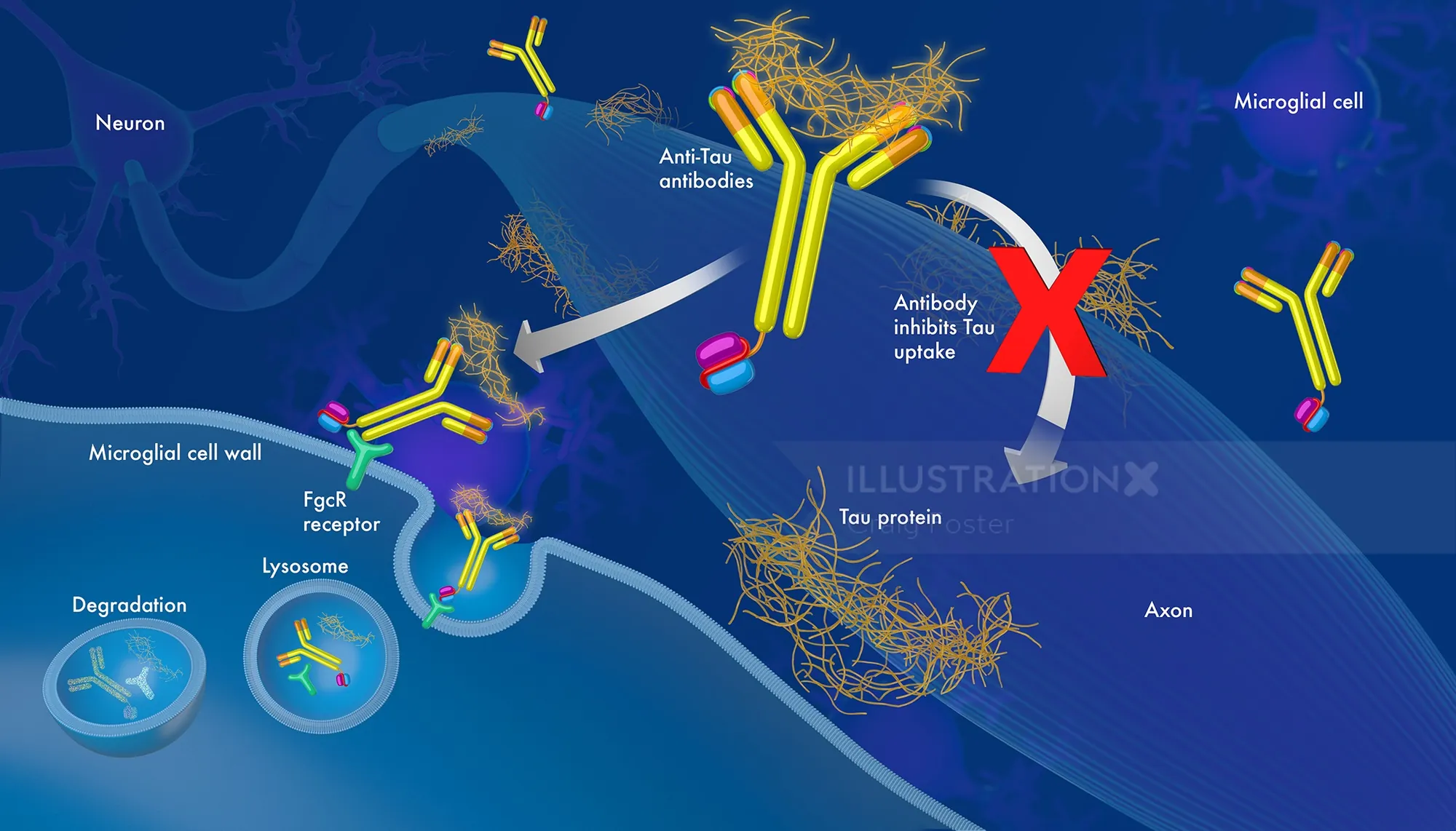 Illustration of tau protein antibody uptake and blockage by microglial cells by Craig Foster