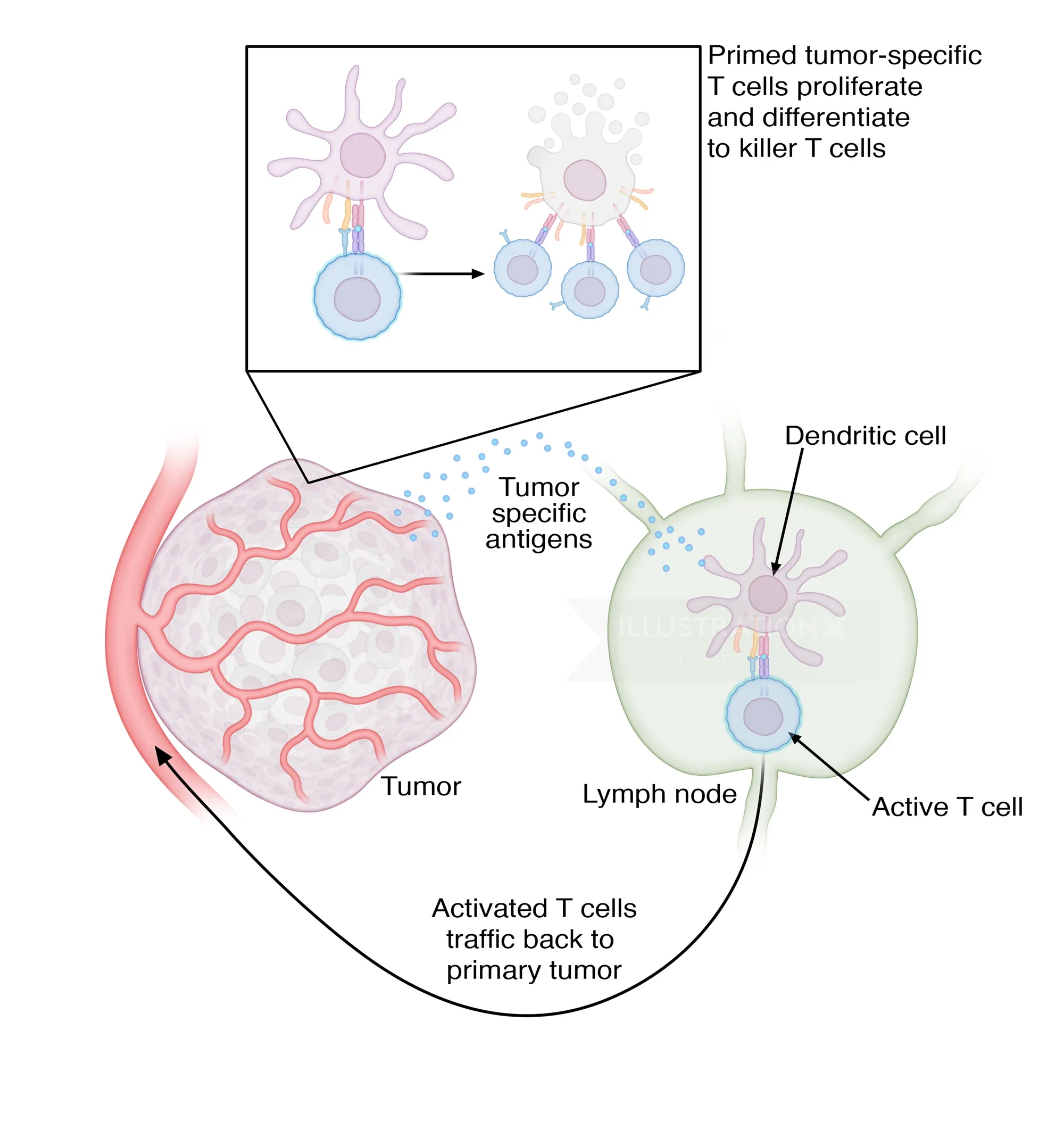 Diagram of tumor antigens activating T cells and dendritic cells by Craig Foster
