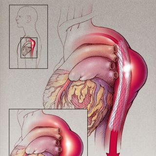 Craig Foster - Medical illustrator. USA