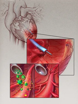 Ilustração de terapia VEGF para coração