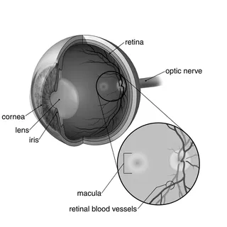 Ilustração de Degeneração Macular por Craig Foster