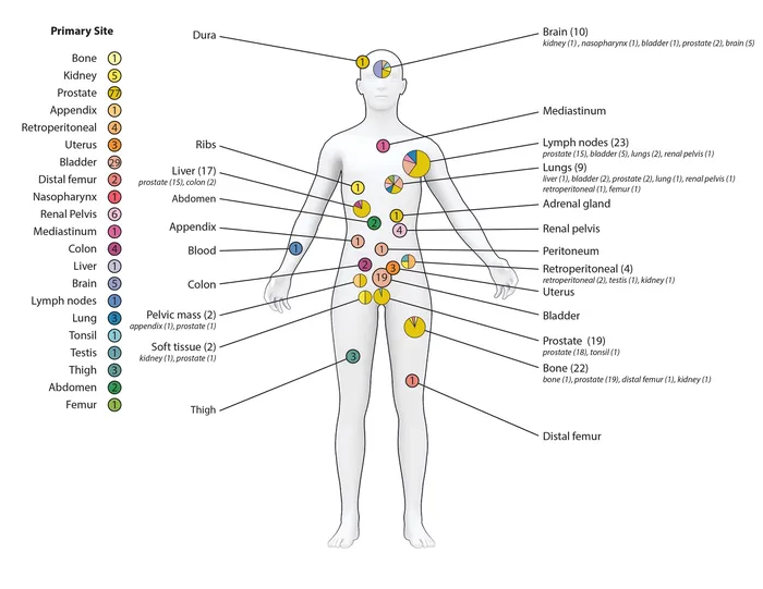 An illustration of cancer locations hr