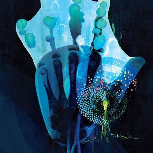 Medical illustration of hand x-ray