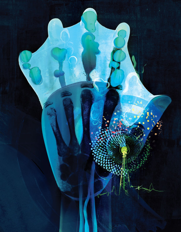 Illustration médicale de la radiographie des mains