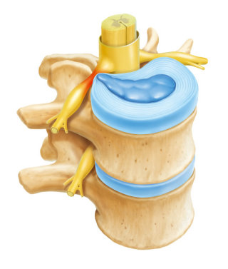 Columna vertebral| Colección de ilustraciones médicas