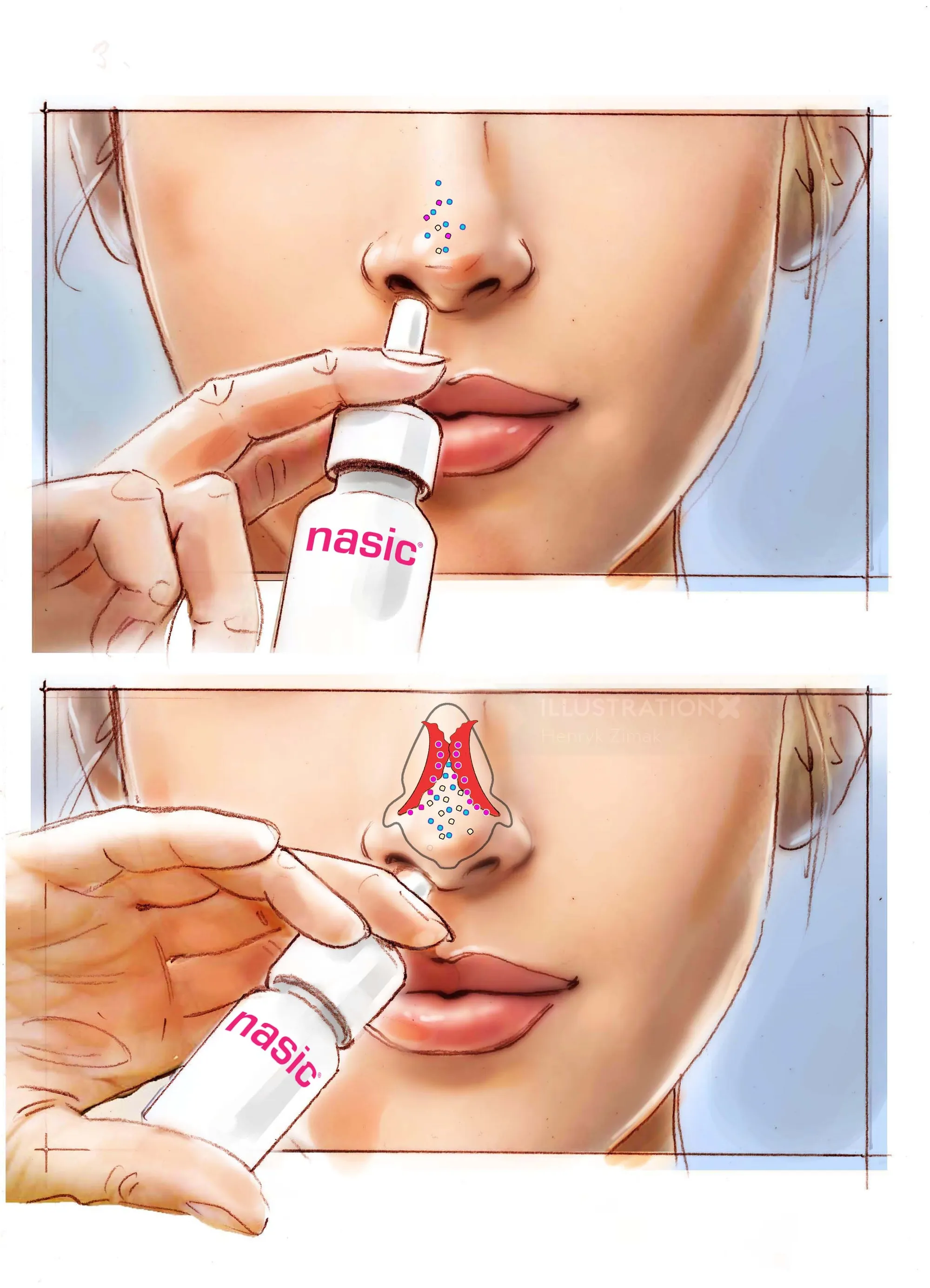 Two-panel illustration showing nasal spray usage instructions by Henryk Zimak