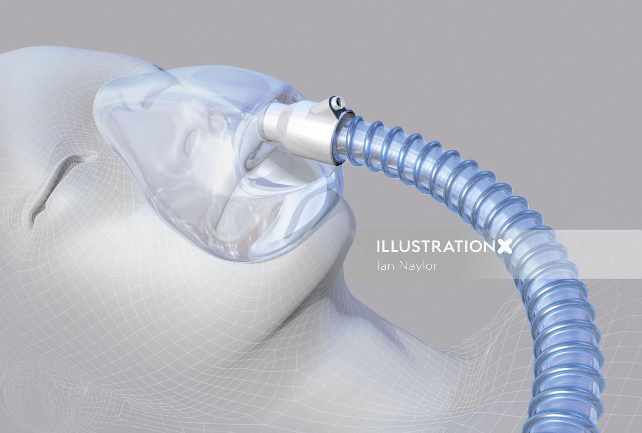 An illustration of Oxygen pipe and mask