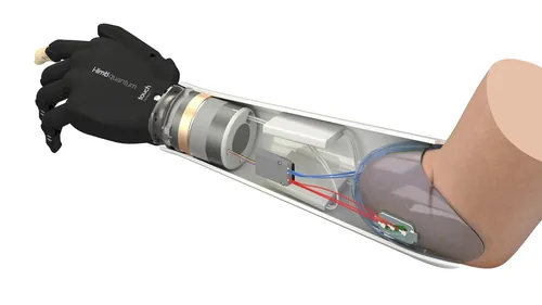 Supro Wrist 의수 내부 구성 요소 (작성자: InfoTec)