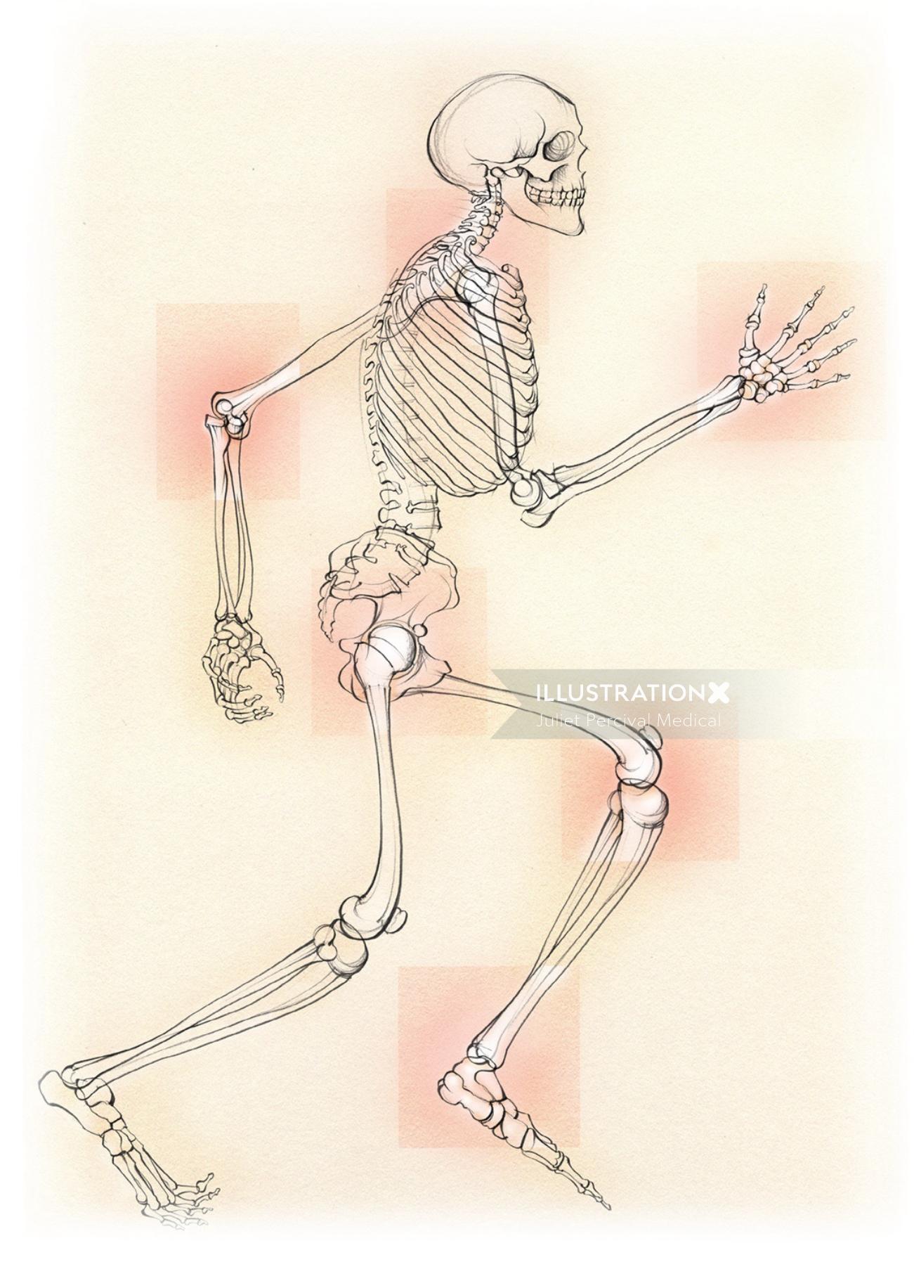 医療、解剖学、骨格、変形性関節症、関節