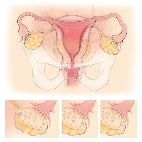 ovulation, ovary, follicle, fallopian tubes, uterus, pelvis, womb, female reproductive organs