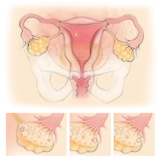 ovulation, ovaire, follicule, trompes de Fallope, utérus, bassin, utérus, organes reproducteurs féminins