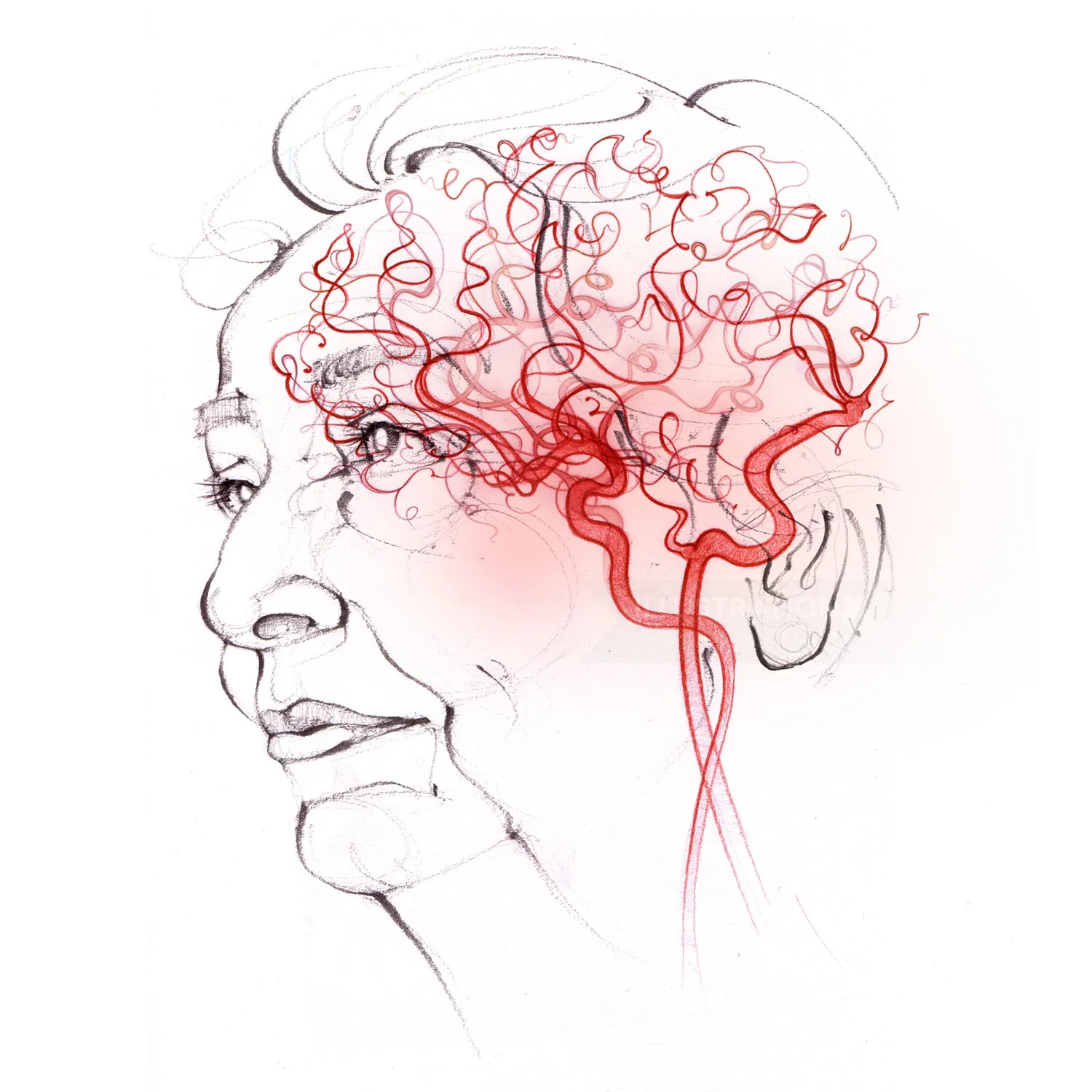 vascular dementia, anatomy, face, head, cerebral circulation