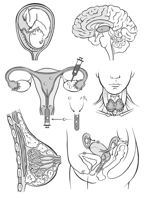 解剖学，妇女，子宫，体外受精，甲状腺肿，乳房，子宫