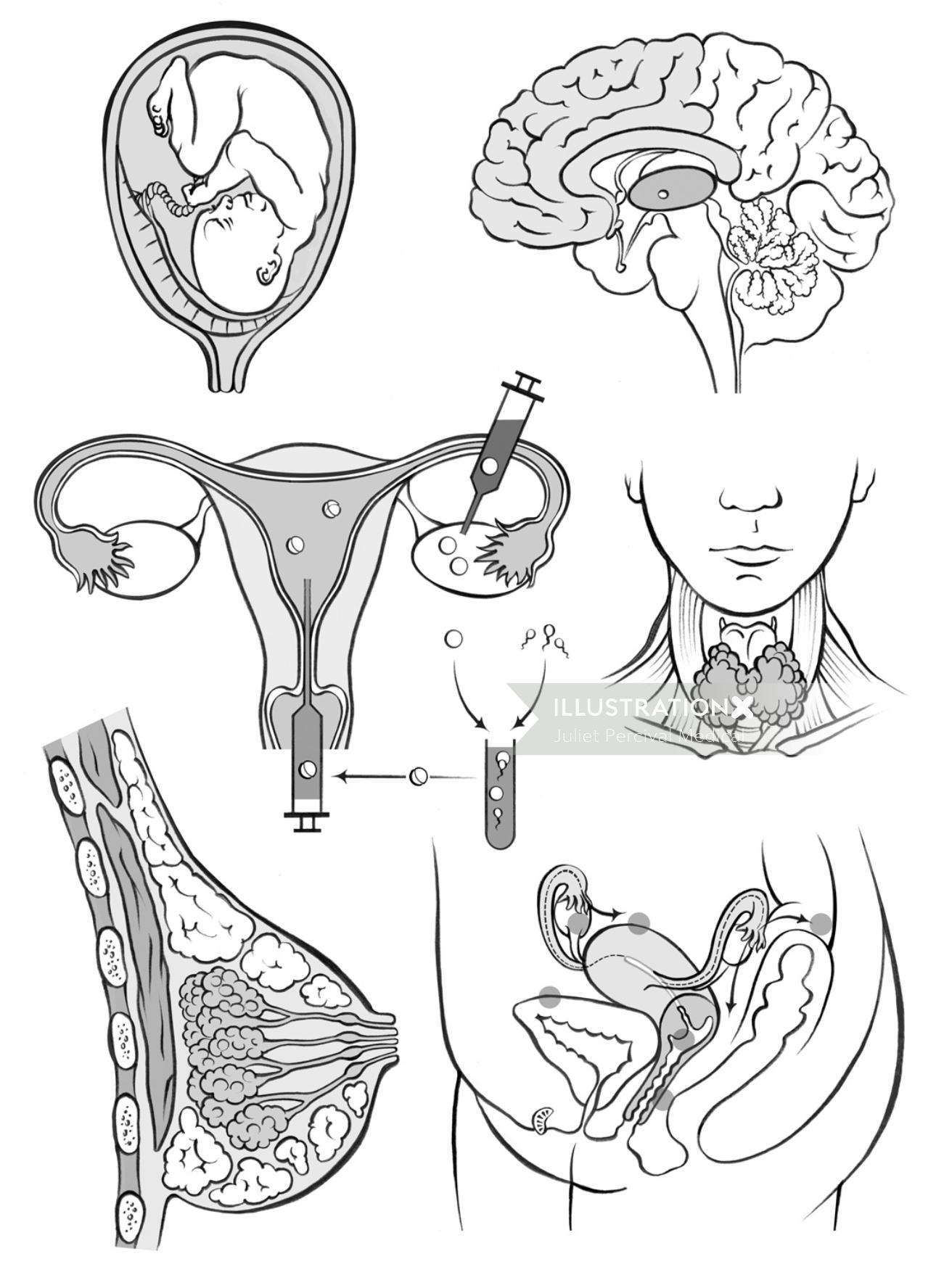 anatomie, femmes, utérus, FIV, goitre, sein, utérus