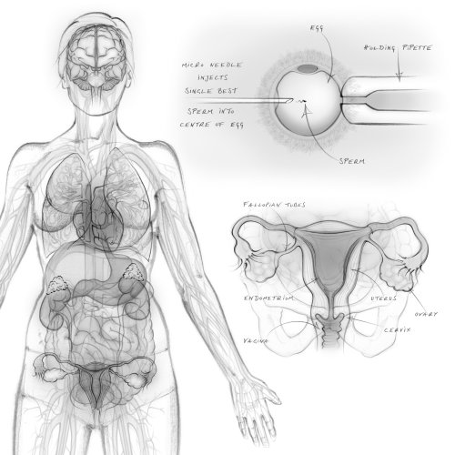 Artwork of Female Reproductive Organs