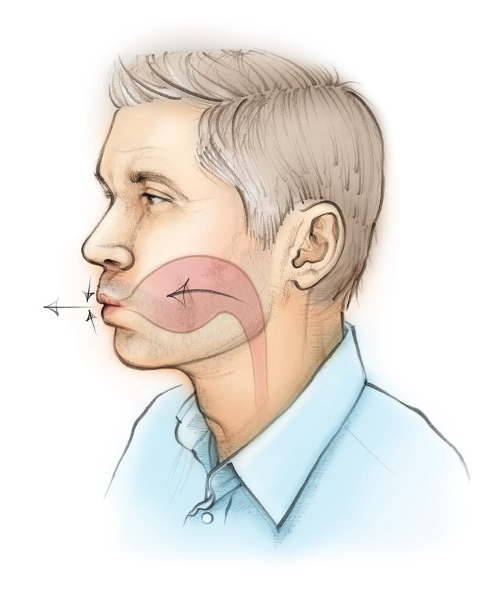 Chronic obstructive pulmonary disease,  patient, breathing, pursed lips