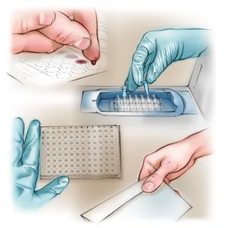 blood test, laboratory, ELISA, test results