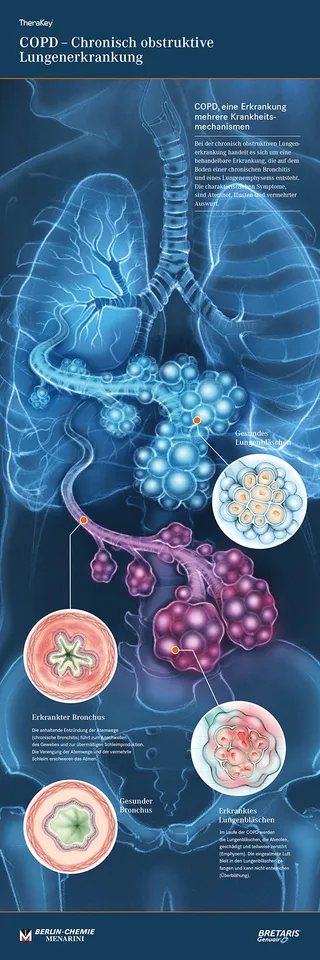 anatomy, lungs, bronchiole, alveoli, pathology