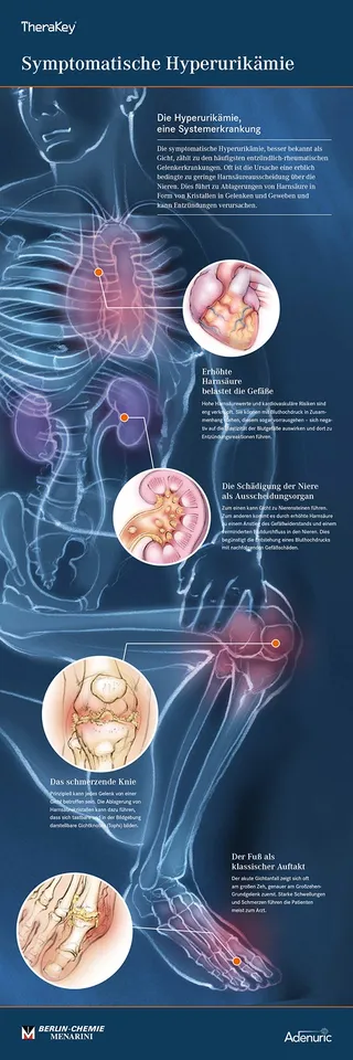 diabetes, anatomy, pathology, heart, kidney, knee, uric acid, skeleton