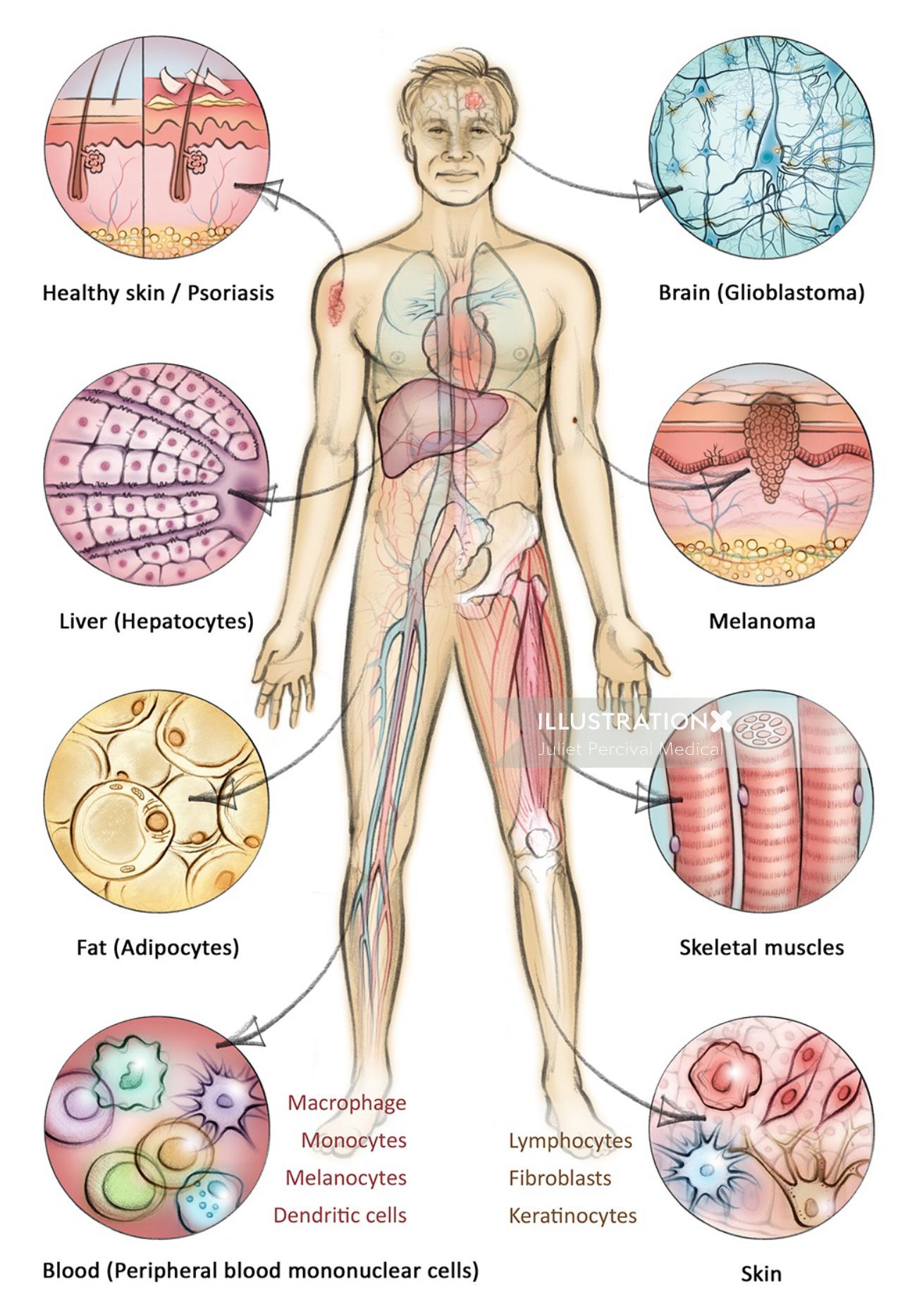 histologie, cellules, mélanome, peau, foie, anatomie, sang