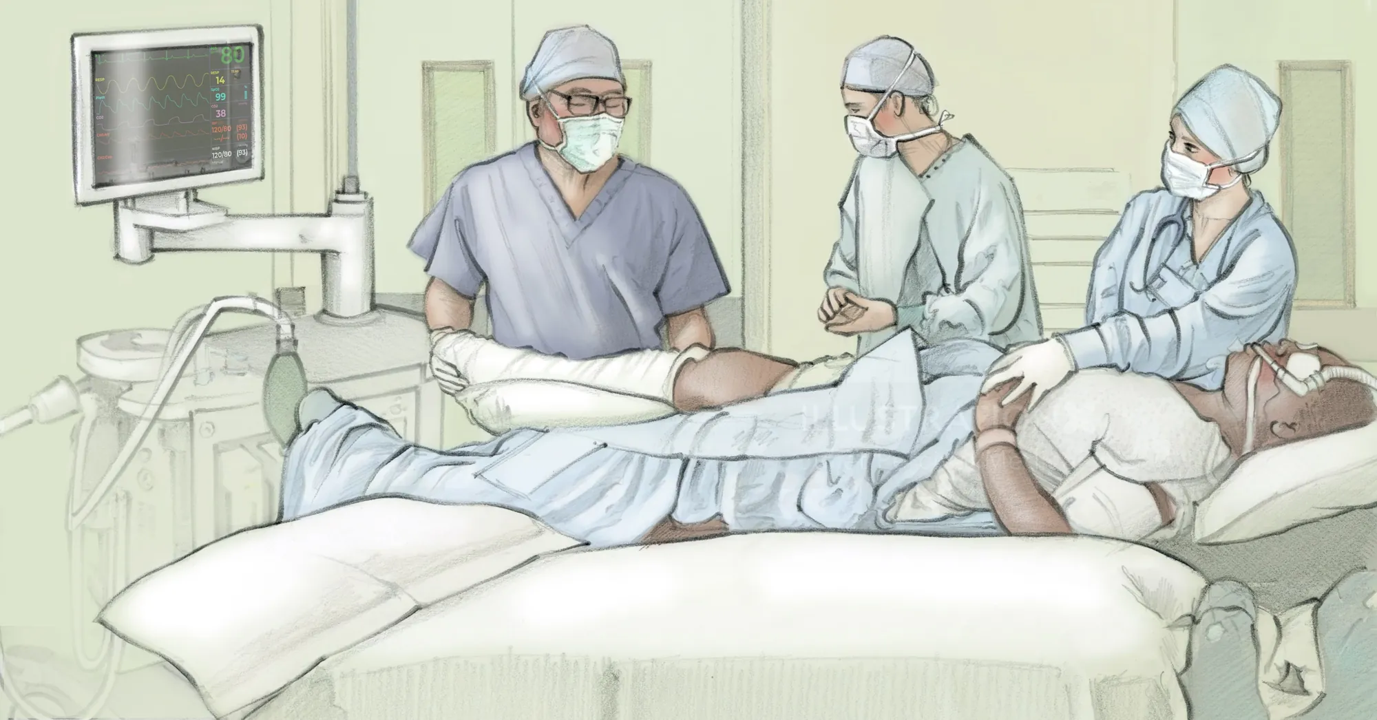 Medical team in hospital performing spinal or epidural anaesthesia