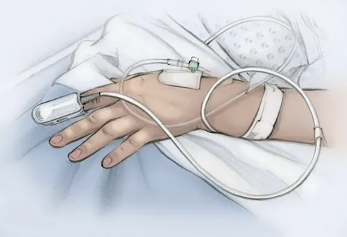 Hand with IV line inserted, connected to medical tubing