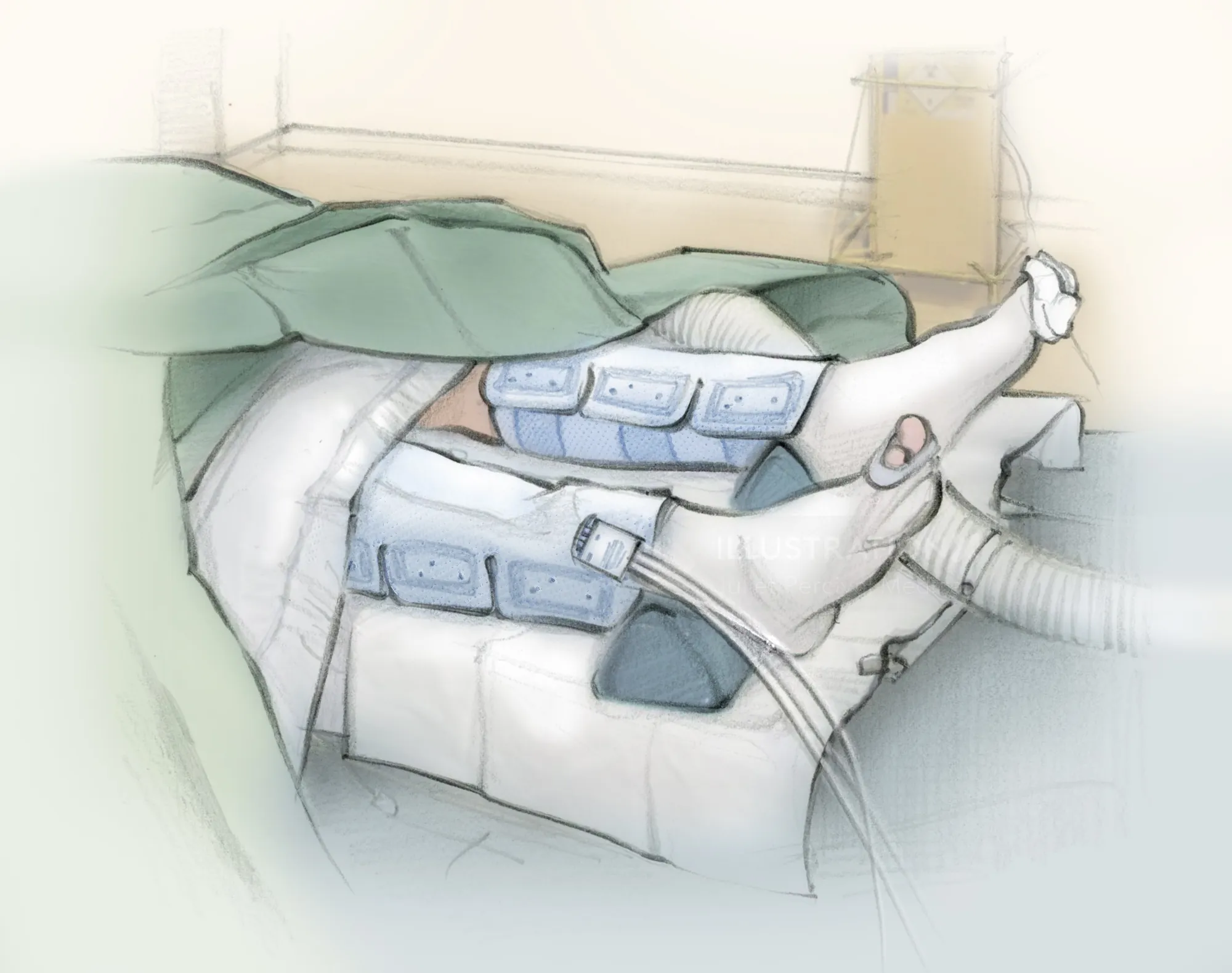Patient in hospital bed with leg braces and medical equipment