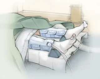 Patient in hospital bed with leg braces and medical equipment