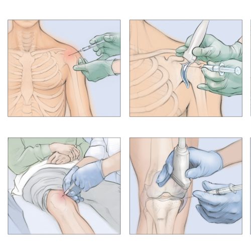 Juliet Percival Medical Infographic Illustrator from United Kingdom