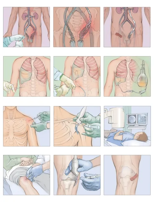 Medical illustrations showing minimally invasive procedures on the chest and knee