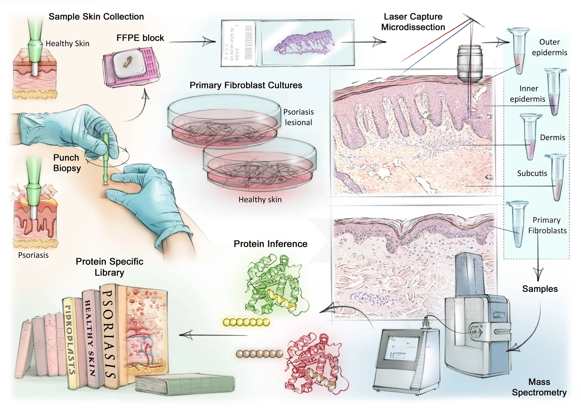 Diagram showing sample skin collection and laser capture microdissection process
