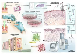 Skin Sample Processing for Protein Research | Illustration by Juliet ...