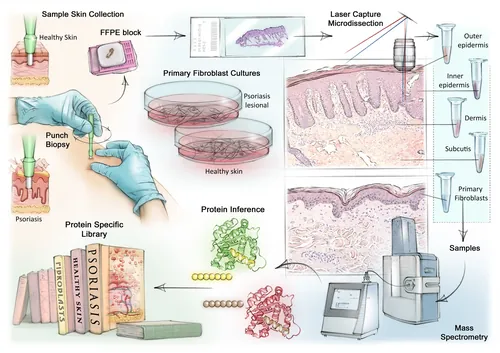 Diagram showing sample skin collection and laser capture microdissection process