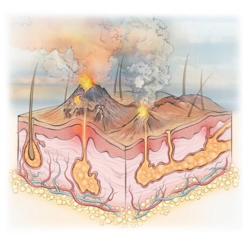 Juliet Percival Medical Educational Illustrator from United Kingdom