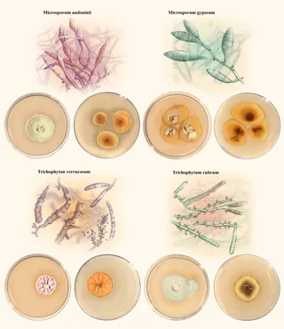 Illustrations and petri dishes showing various fungi and molds