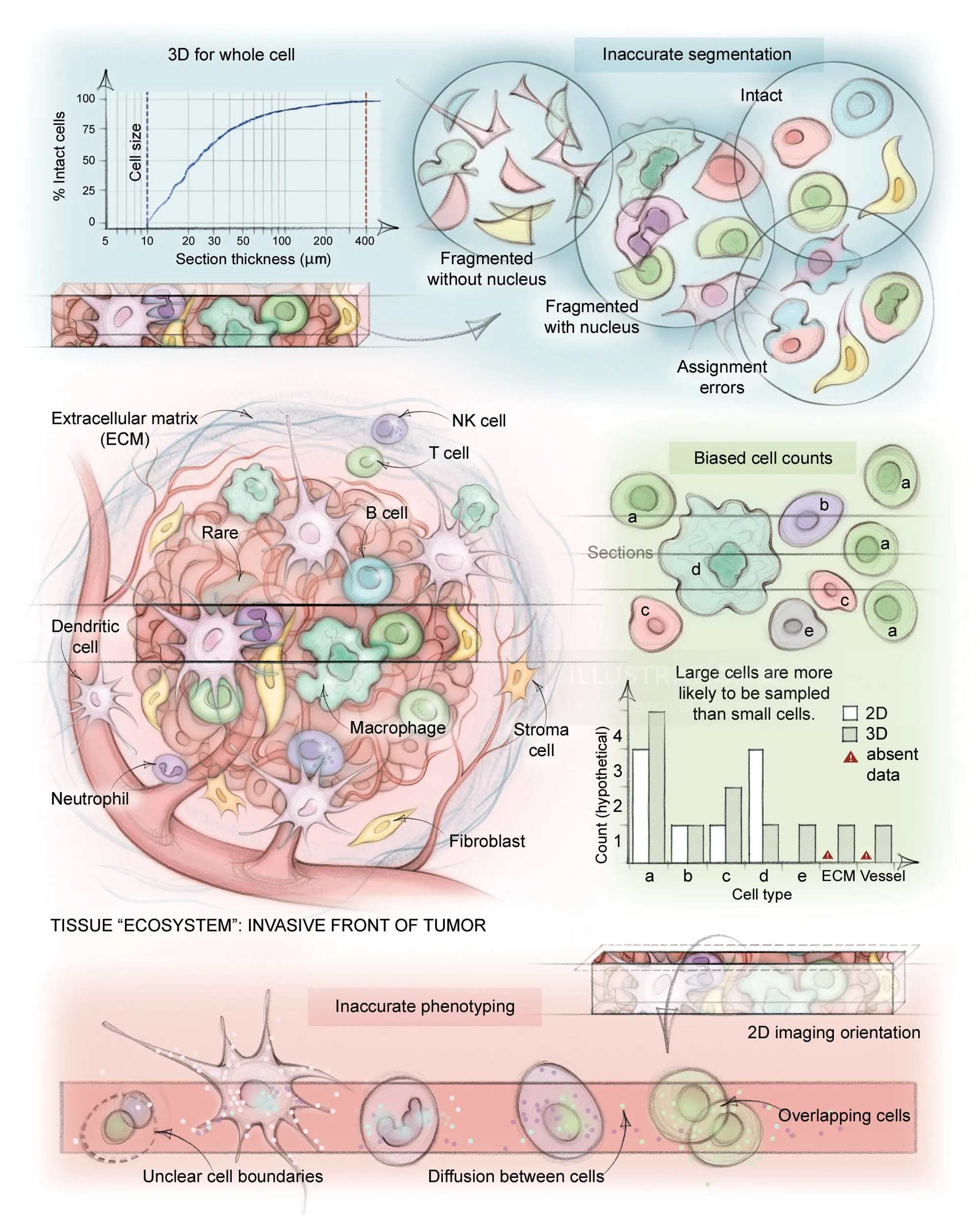 Detailed spatial biology illustration showing tumor ecosystem and cell interactions by Juliet Perciv