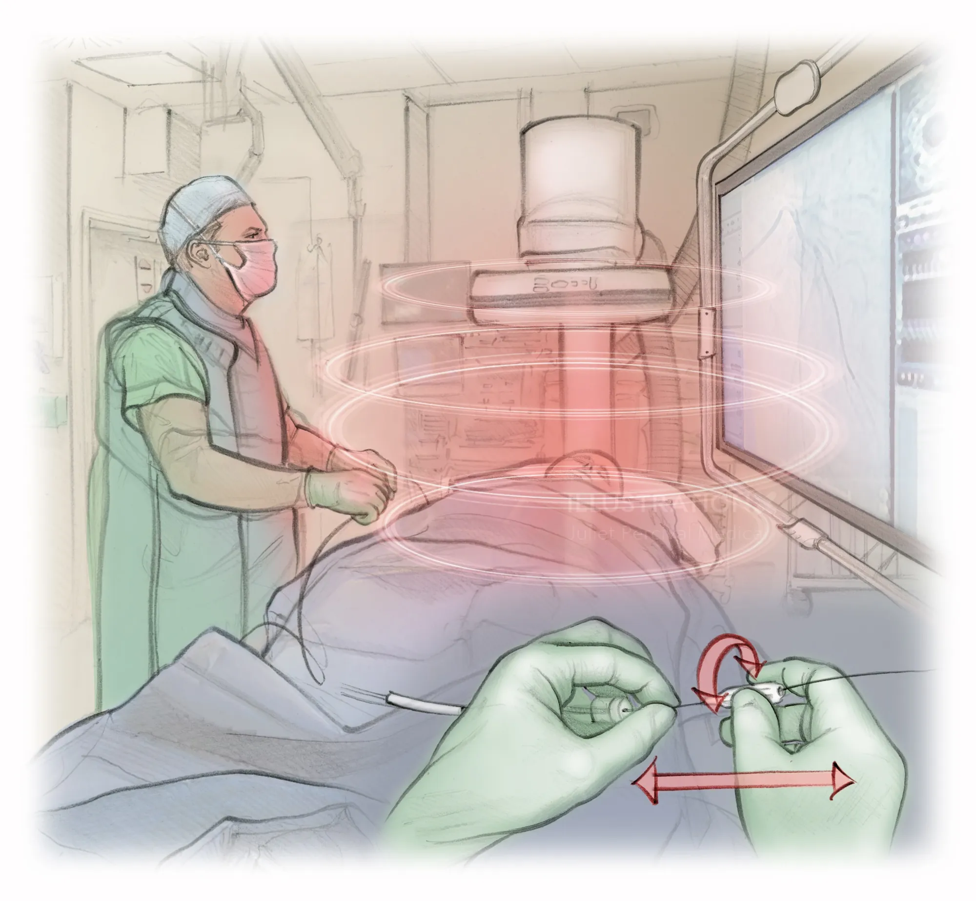 Clinician manipulating guidewire using Machnet robot in radiology theatre by Juliet Percival Medical