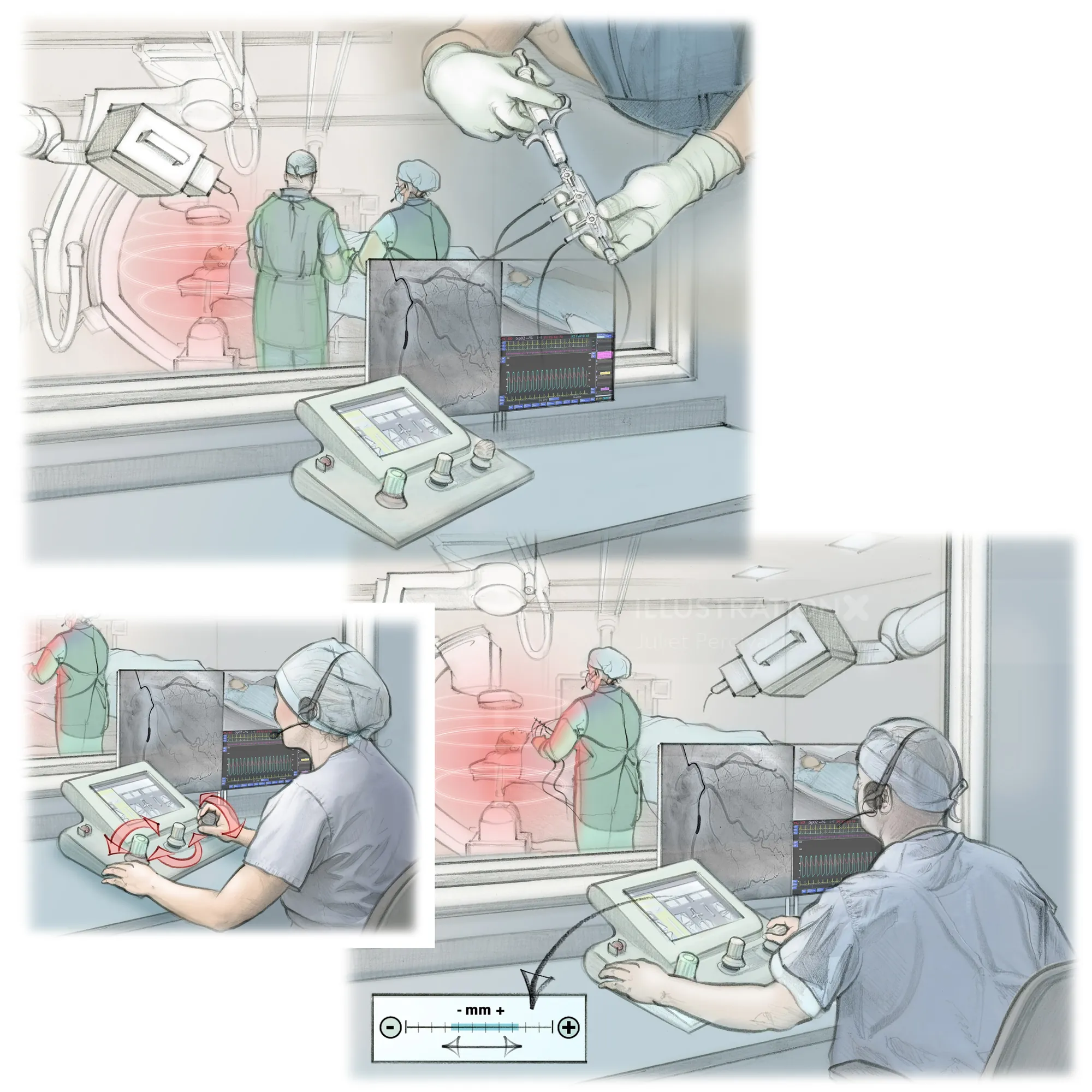 Medical illustrations of clinician using Machnet robot in radiology, by Juliet Percival Medical