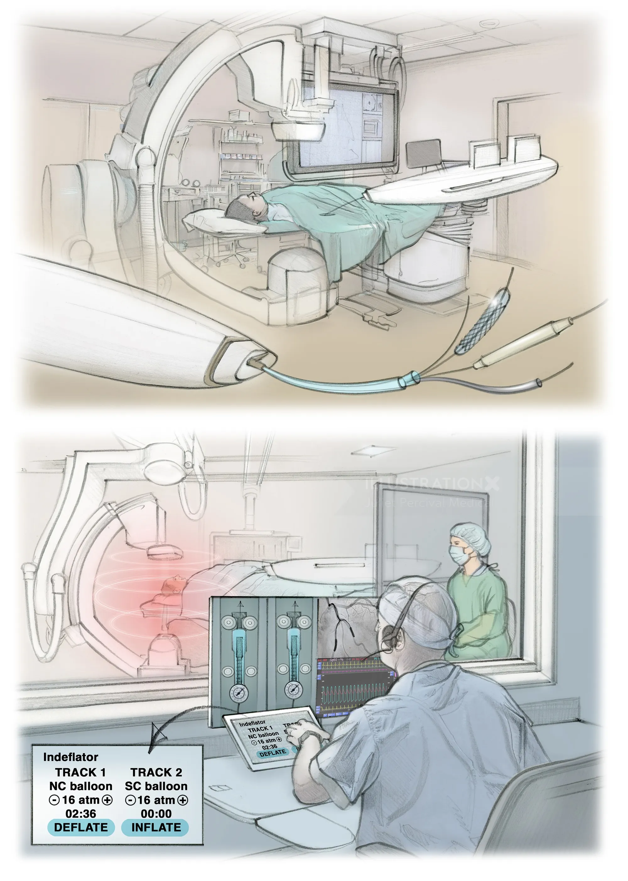 Machnet robot and clinician operating console in radiology theatre by Juliet Percival Medical