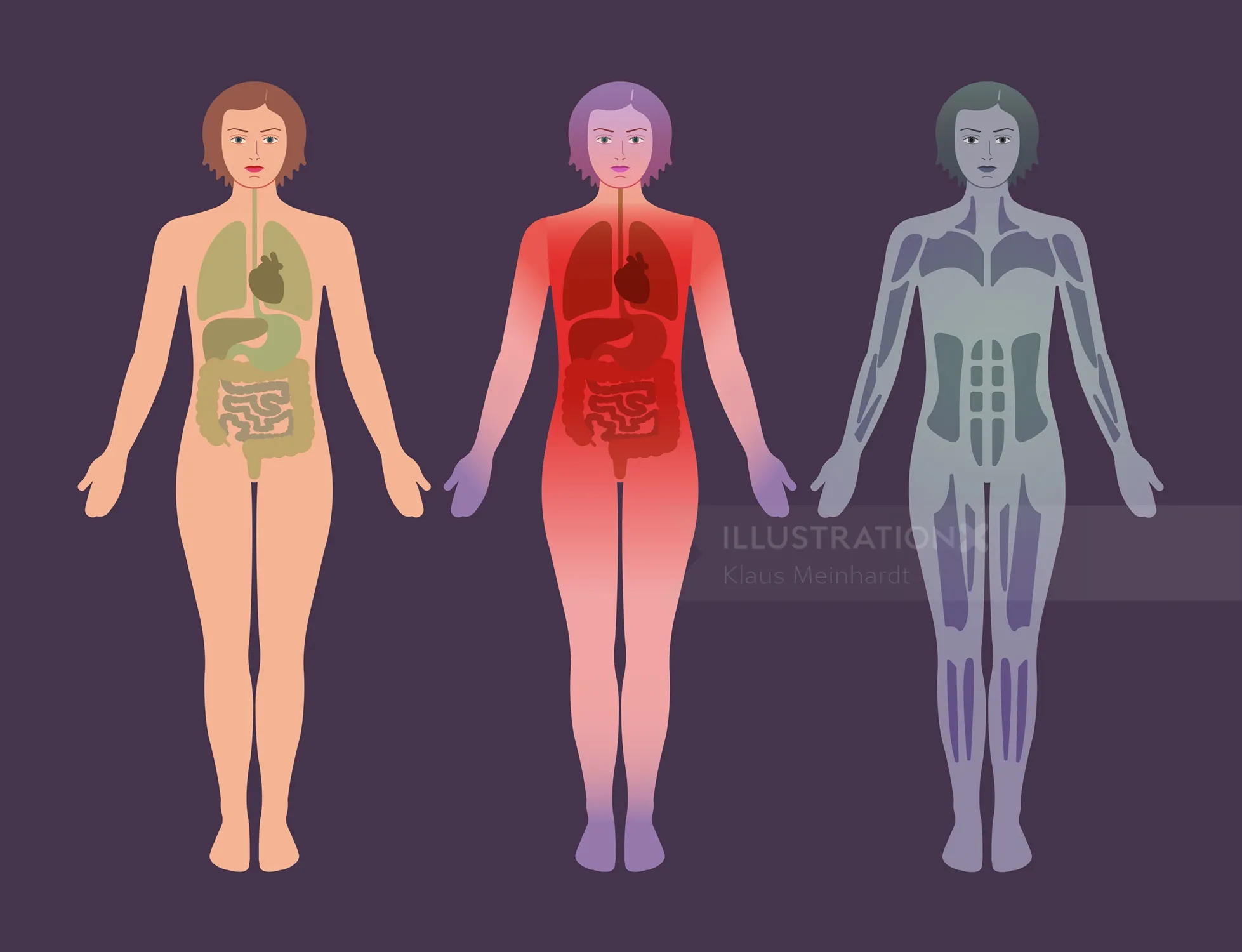 Illustration of three female bodies highlighting internal organs and nerves