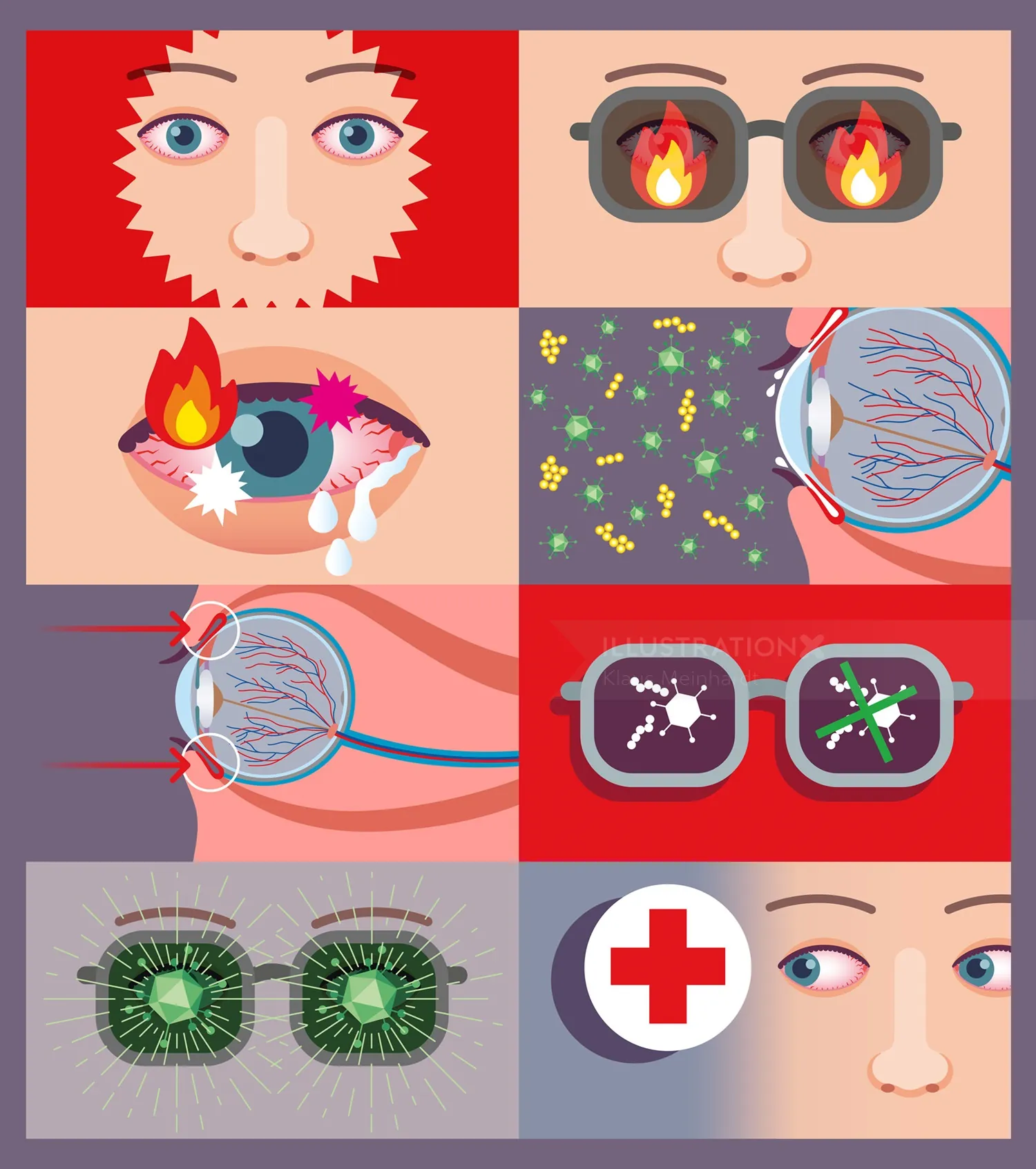 Illustration depicting eye irritation, allergies, and eye protection with sunglasses